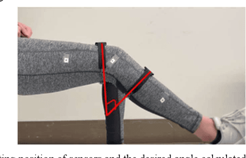 Figure 1 for Range of Motion Sensors for Monitoring Recovery of Total Knee Arthroplasty