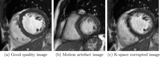 Figure 1 for Deep Learning using K-space Based Data Augmentation for Automated Cardiac MR Motion Artefact Detection