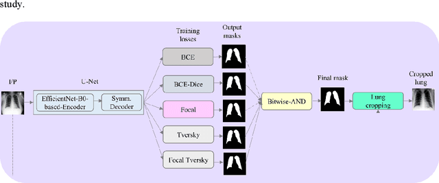 Figure 1 for Multi-loss ensemble deep learning for chest X-ray classification