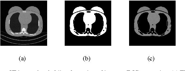 Figure 1 for Automated Selection of Uniform Regions for CT Image Quality Detection