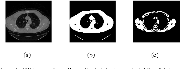 Figure 3 for Automated Selection of Uniform Regions for CT Image Quality Detection