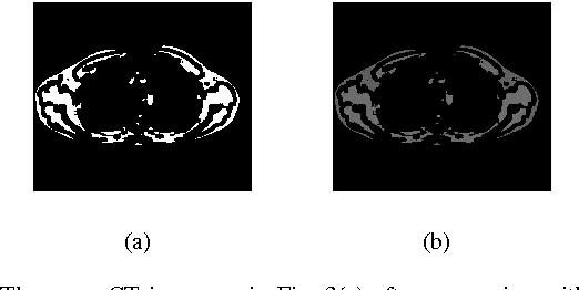 Figure 4 for Automated Selection of Uniform Regions for CT Image Quality Detection