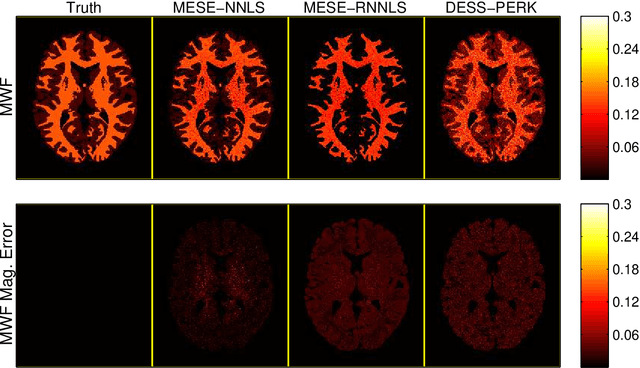 Figure 2 for Fast, Precise Myelin Water Quantification using DESS MRI and Kernel Learning