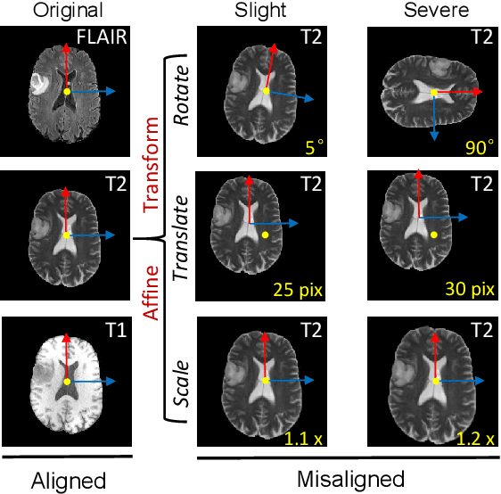 Figure 1 for FedMed-ATL: Misaligned Unpaired Brain Image Synthesis via Affine Transform Loss