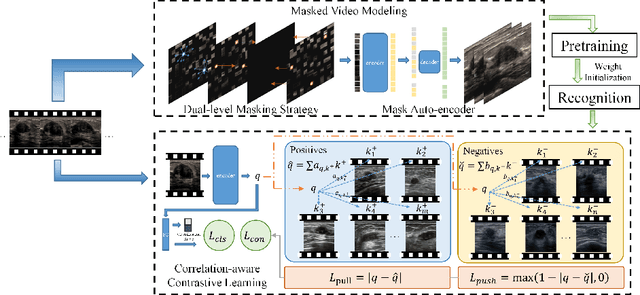 Figure 3 for Masked Video Modeling with Correlation-aware Contrastive Learning for Breast Cancer Diagnosis in Ultrasound