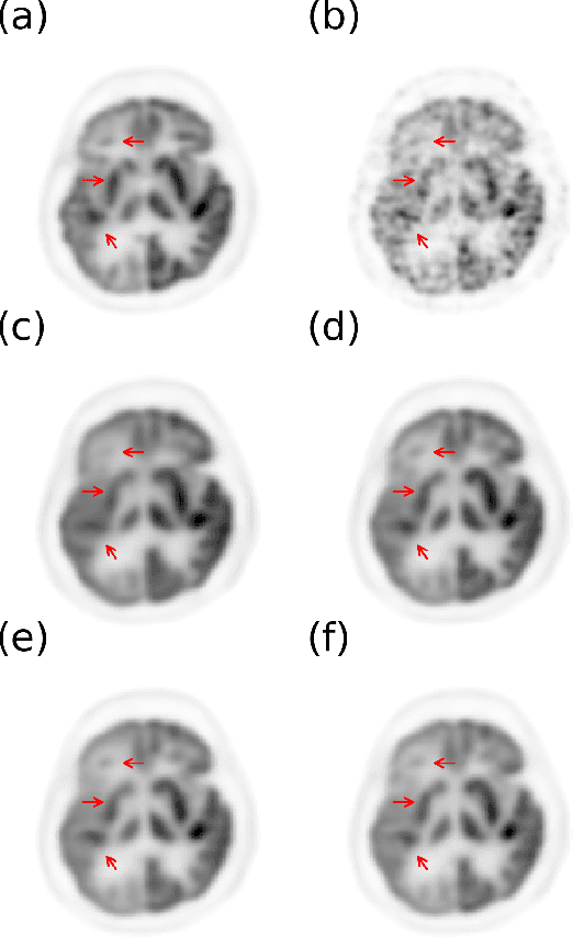 Figure 3 for 200x Low-dose PET Reconstruction using Deep Learning