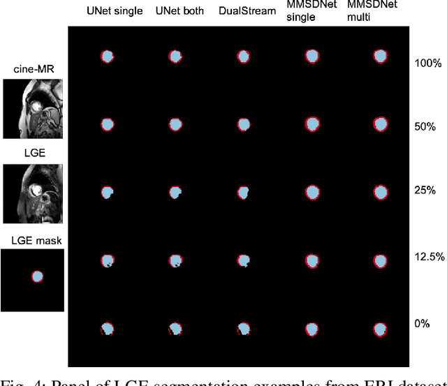 Figure 4 for Disentangle, align and fuse for multimodal and zero-shot image segmentation