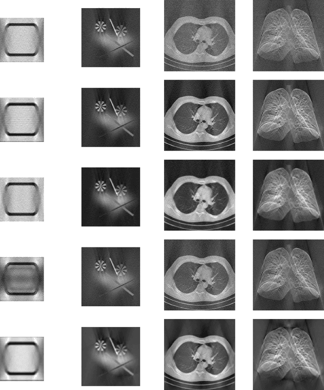 Figure 3 for Sparse Filtered SIRT for Electron Tomography