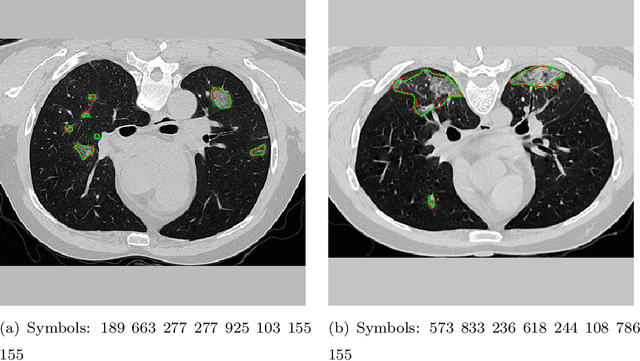 Figure 1 for Symbolic Semantic Segmentation and Interpretation of COVID-19 Lung Infections in Chest CT volumes based on Emergent Languages