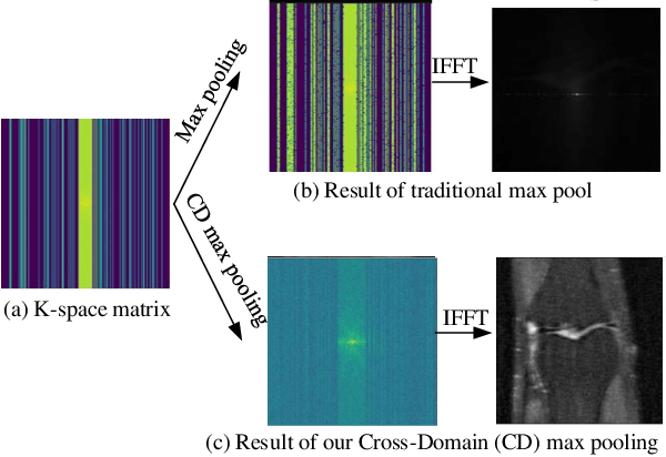Figure 4 for Dual-Domain Reconstruction Networks with V-Net and K-Net for fast MRI