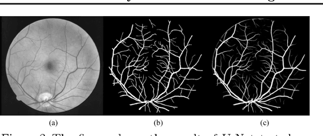 Figure 3 for A Novel Hybrid Machine Learning Model for Auto-Classification of Retinal Diseases
