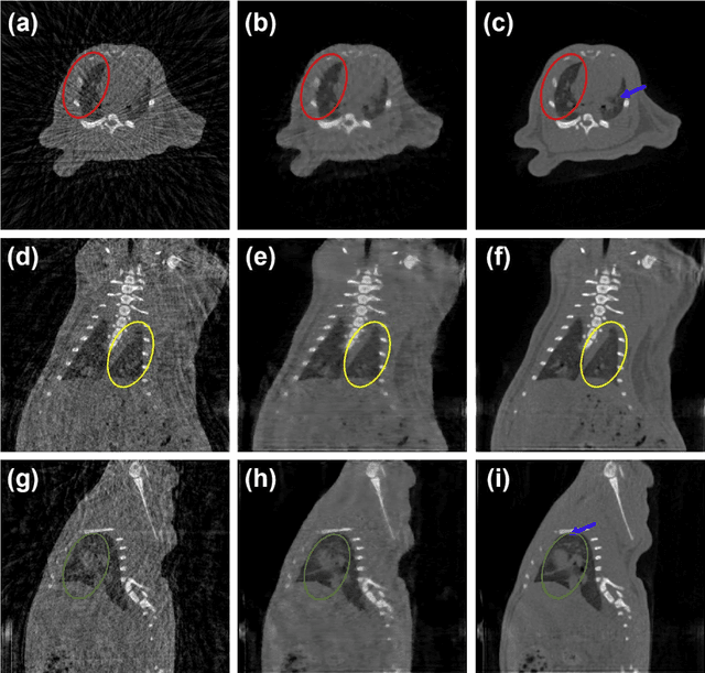 Figure 4 for Stationary Multi-source AI-powered Real-time Tomography (SMART) for Dynamic Cardiac Imaging