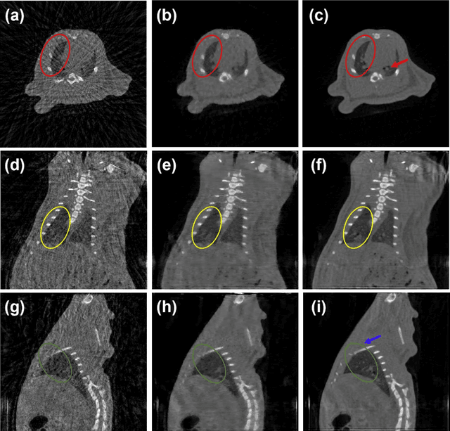 Figure 3 for Stationary Multi-source AI-powered Real-time Tomography (SMART) for Dynamic Cardiac Imaging