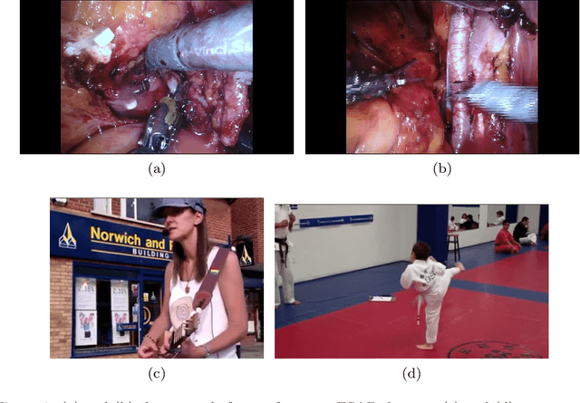Figure 1 for The SARAS Endoscopic Surgeon Action Detection (ESAD) dataset: Challenges and methods