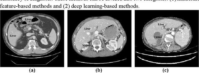 Figure 1 for EAR-U-Net: EfficientNet and attention-based residual U-Net for automatic liver segmentation in CT