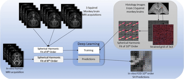 Figure 1 for Deep Learning Captures More Accurate Diffusion Fiber Orientations Distributions than Constrained Spherical Deconvolution