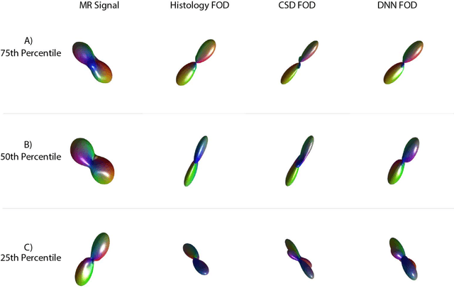 Figure 3 for Deep Learning Captures More Accurate Diffusion Fiber Orientations Distributions than Constrained Spherical Deconvolution