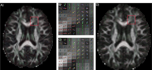 Figure 4 for Deep Learning Captures More Accurate Diffusion Fiber Orientations Distributions than Constrained Spherical Deconvolution