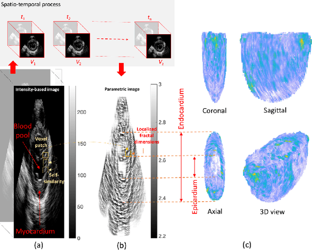 Figure 1 for Spatio-Temporal Segmentation in 3D Echocardiographic Sequences using Fractional Brownian Motion