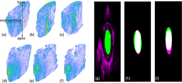 Figure 2 for Spatio-Temporal Segmentation in 3D Echocardiographic Sequences using Fractional Brownian Motion