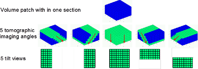 Figure 4 for Super-resolution using Sparse Representations over Learned Dictionaries: Reconstruction of Brain Structure using Electron Microscopy