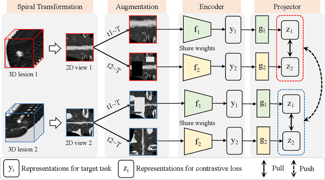 Figure 1 for Spiral Contrastive Learning: An Efficient 3D Representation Learning Method for Unannotated CT Lesions