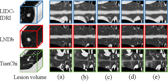 Figure 3 for Spiral Contrastive Learning: An Efficient 3D Representation Learning Method for Unannotated CT Lesions