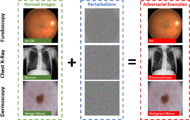 Figure 1 for Understanding Adversarial Attacks on Deep Learning Based Medical Image Analysis Systems
