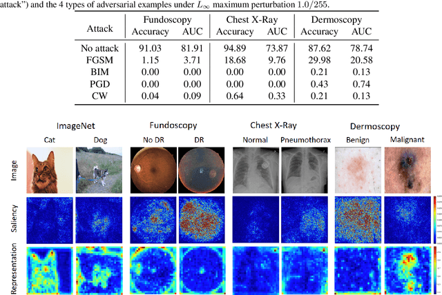 Figure 4 for Understanding Adversarial Attacks on Deep Learning Based Medical Image Analysis Systems