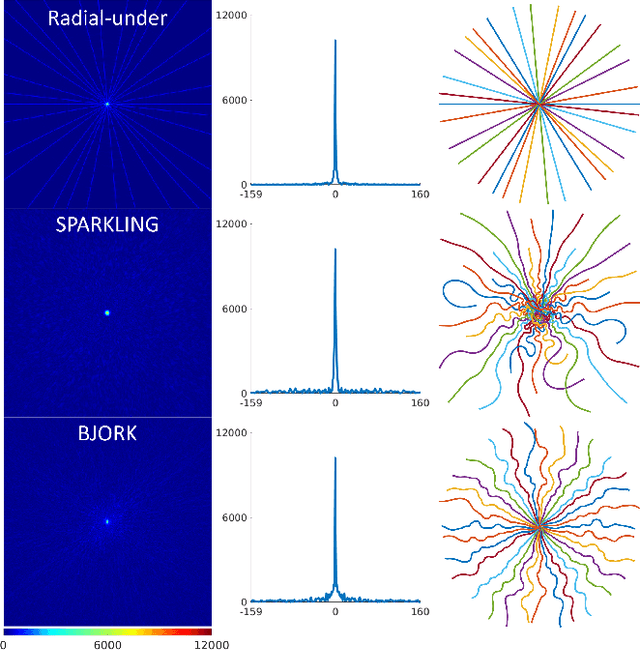 Figure 2 for B-spline Parameterized Joint Optimization of Reconstruction and K-space Trajectories (BJORK) for Accelerated 2D MRI