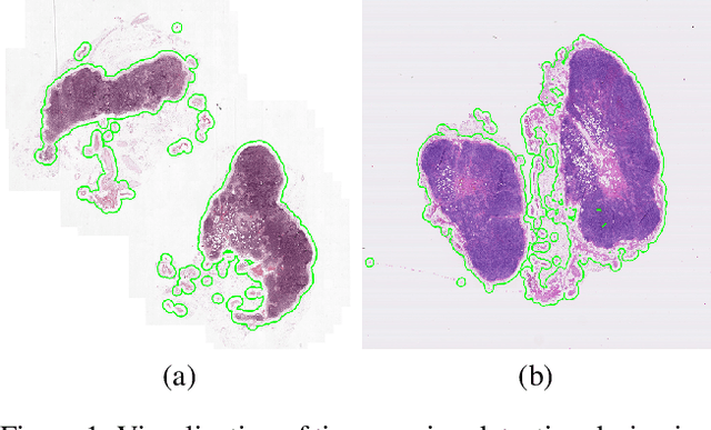 Figure 1 for Deep Learning for Identifying Metastatic Breast Cancer