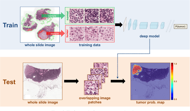 Figure 3 for Deep Learning for Identifying Metastatic Breast Cancer