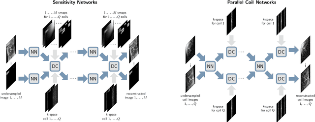 Figure 3 for $Σ$-net: Systematic Evaluation of Iterative Deep Neural Networks for Fast Parallel MR Image Reconstruction