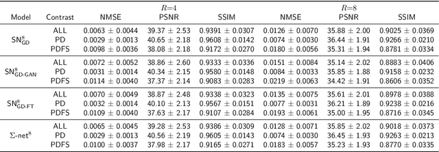 Figure 4 for $Σ$-net: Systematic Evaluation of Iterative Deep Neural Networks for Fast Parallel MR Image Reconstruction