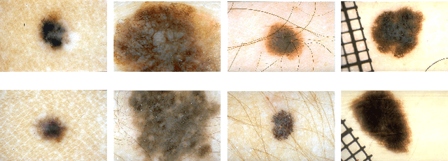 Figure 1 for Towards Automated Melanoma Screening: Proper Computer Vision & Reliable Results
