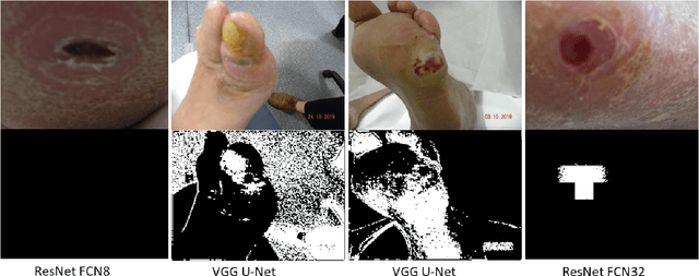 Figure 3 for Translating Clinical Delineation of Diabetic Foot Ulcers into Machine Interpretable Segmentation