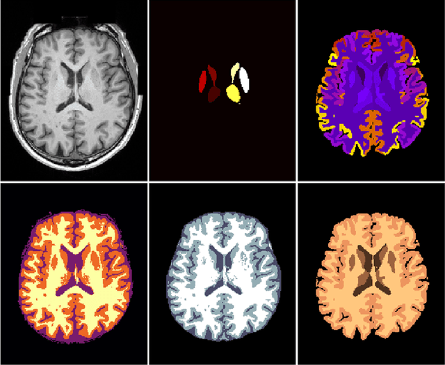 Figure 1 for NeuroNet: Fast and Robust Reproduction of Multiple Brain Image Segmentation Pipelines