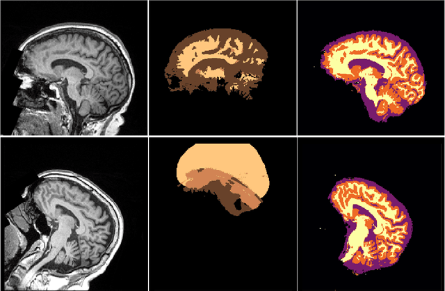 Figure 2 for NeuroNet: Fast and Robust Reproduction of Multiple Brain Image Segmentation Pipelines