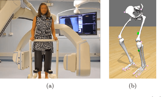 Figure 1 for Rigid and non-rigid motion compensation in weight-bearing cone-beam CT of the knee using (noisy) inertial measurements