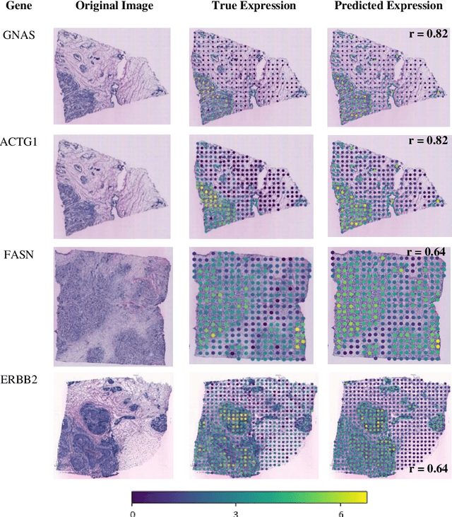 Figure 4 for All You Need is Color: Image based Spatial Gene Expression Prediction using Neural Stain Learning