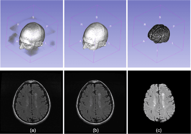 Figure 2 for Multiple Sclerosis Lesion Analysis in Brain Magnetic Resonance Images: Techniques and Clinical Applications