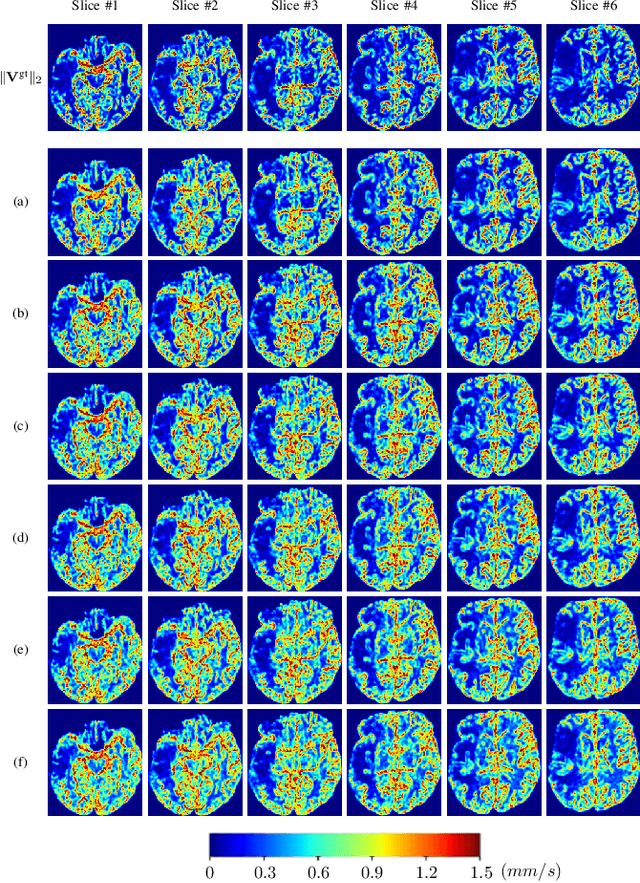 Figure 4 for Perfusion Imaging: A Data Assimilation Approach