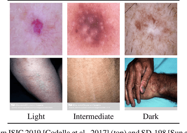 Figure 3 for Out-of-Distribution Detection in Dermatology using Input Perturbation and Subset Scanning
