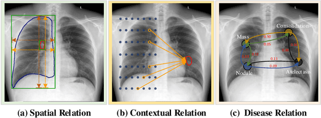 Figure 1 for A Structure-Aware Relation Network for Thoracic Diseases Detection and Segmentation