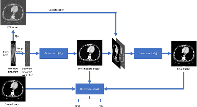 Figure 1 for Dual Network Architecture for Few-view CT -- Trained on ImageNet Data and Transferred for Medical Imaging