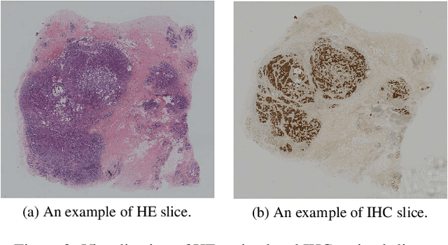 Figure 2 for BCI: Breast Cancer Immunohistochemical Image Generation through Pyramid Pix2pix