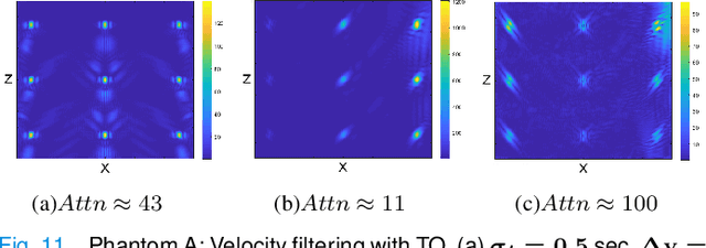 Figure 3 for Circumventing the resolution-time tradeoff in Ultrasound Localization Microscopy by Velocity Filtering
