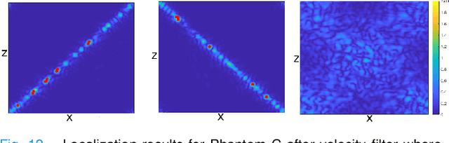 Figure 4 for Circumventing the resolution-time tradeoff in Ultrasound Localization Microscopy by Velocity Filtering