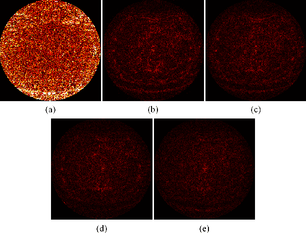 Figure 3 for Sparse-View CT Reconstruction via Convolutional Sparse Coding
