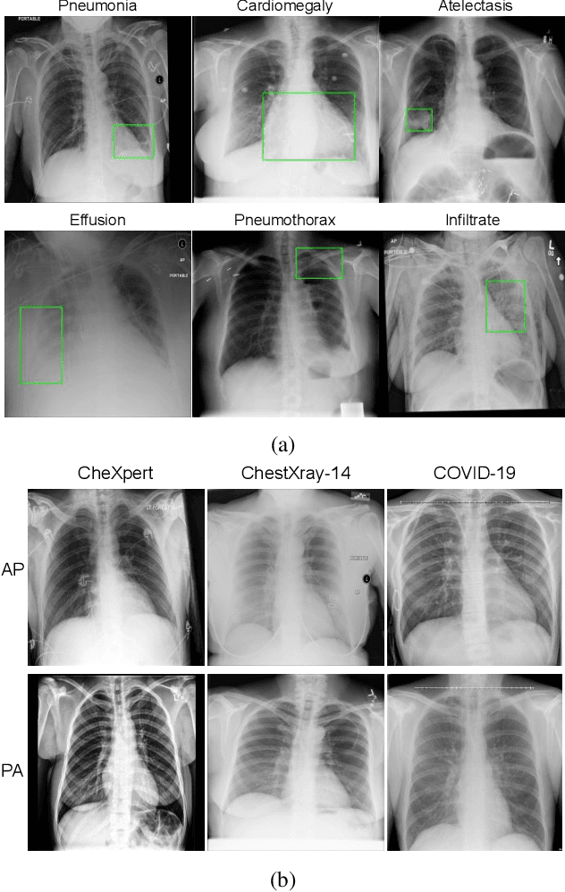 Figure 1 for Multi-Task Driven Explainable Diagnosis of COVID-19 using Chest X-ray Images